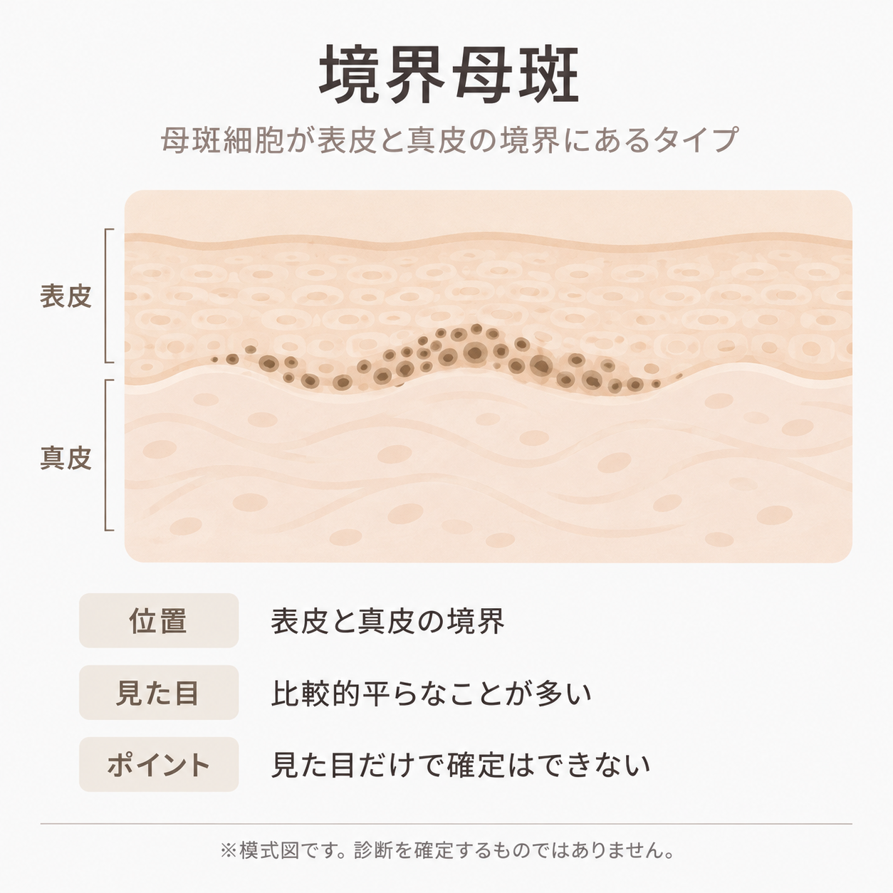 境界母斑の母斑細胞の位置を示す皮膚断面イラスト